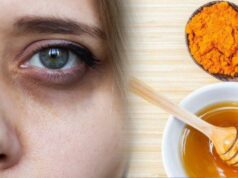 கண்ணுக்கு கீழ கருவளையமா..?? கவலையே வேண்டாம் இத பண்ணுங்க ..!!